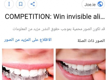  اسعار تقويم الاسنان الشفاف في مصر 